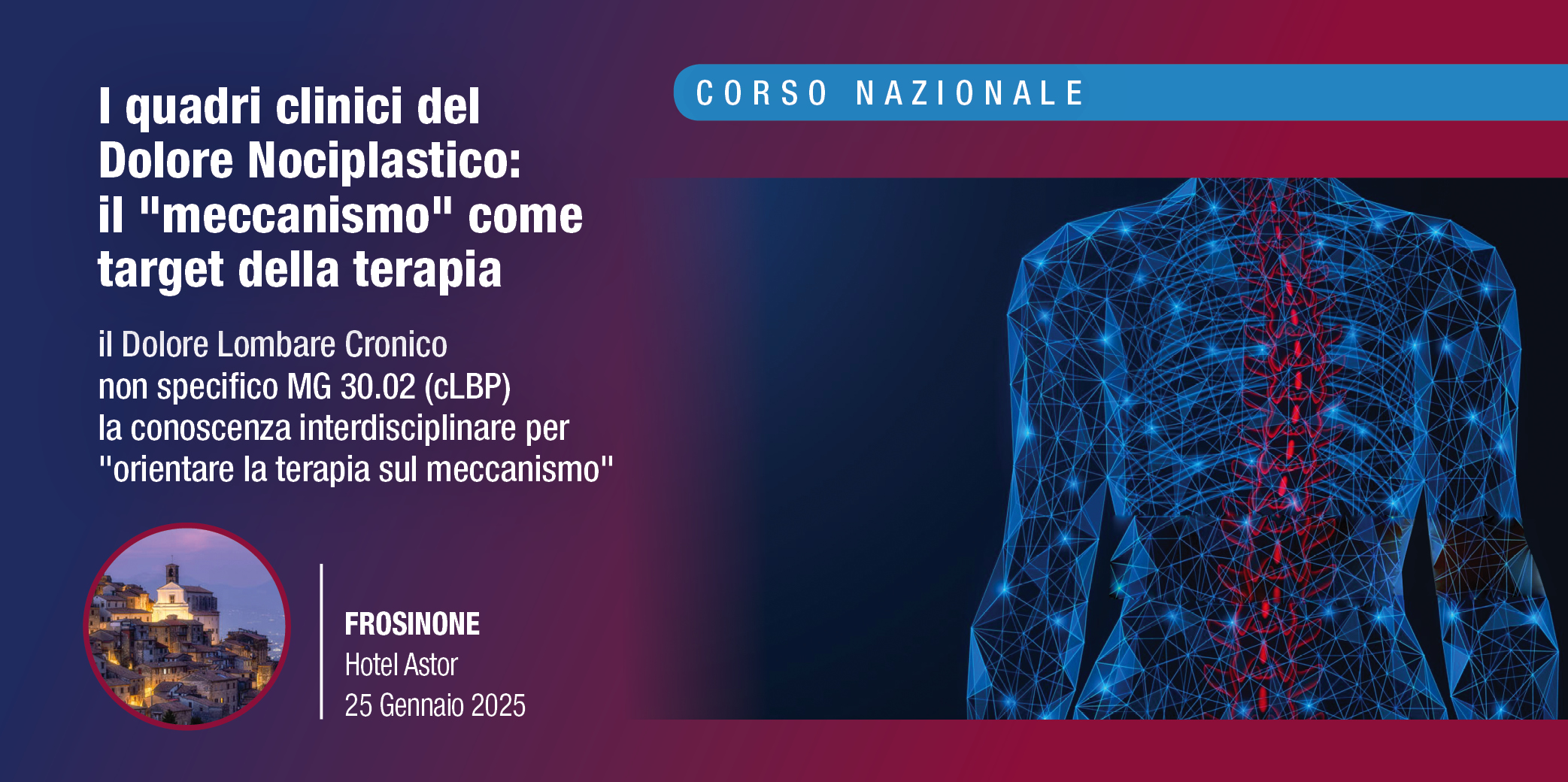 Frosinone, 25 Gennaio 2025- Corso Res: “I quadri clinici del Dolore Nociplastico: il “meccanismo” come target della terapia