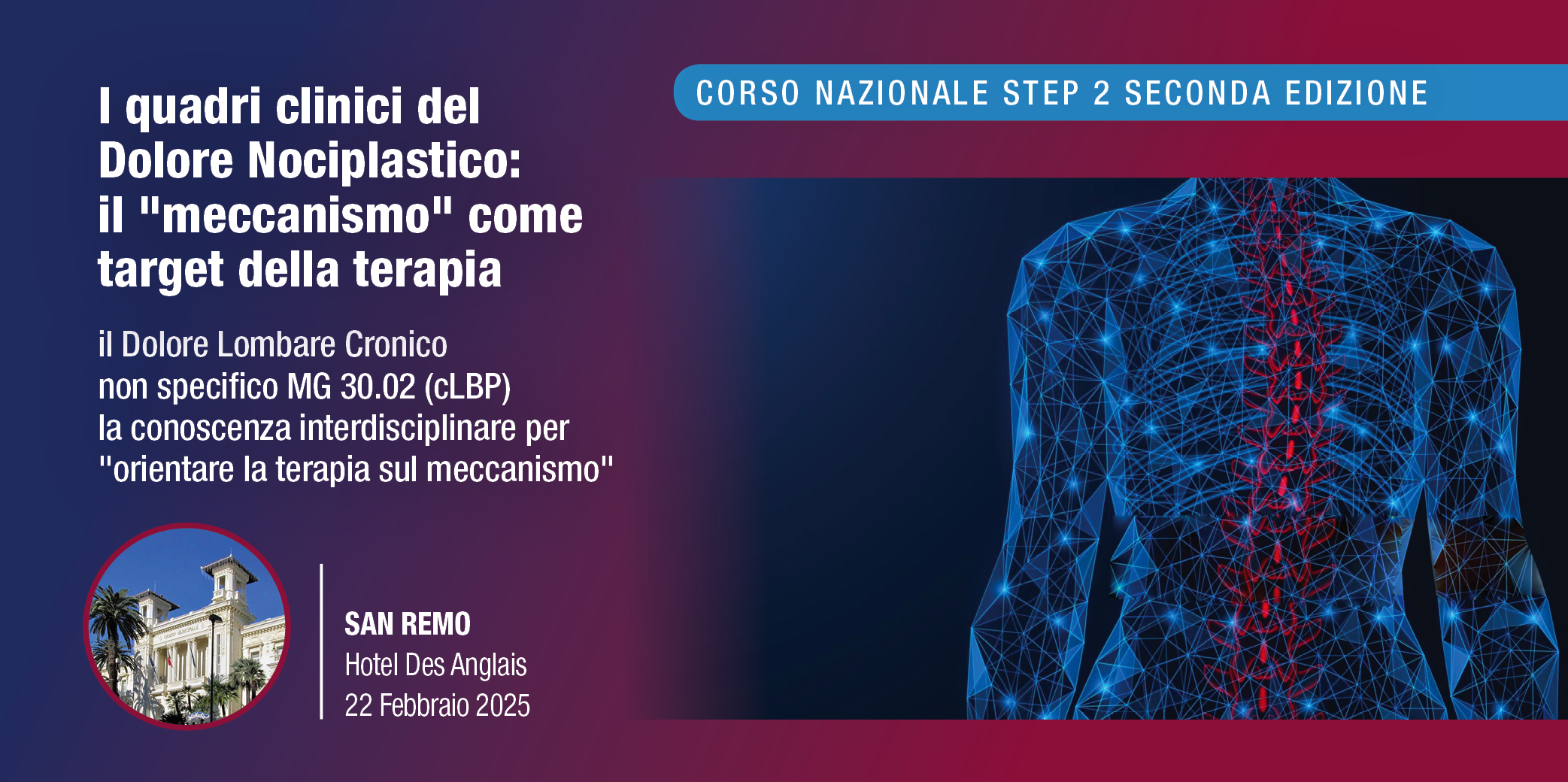 Sanremo, 22 Febbraio 2025 – Corso RES: I quadri clinici del Dolore Nociplastico: il “meccanismo” come target della terapia