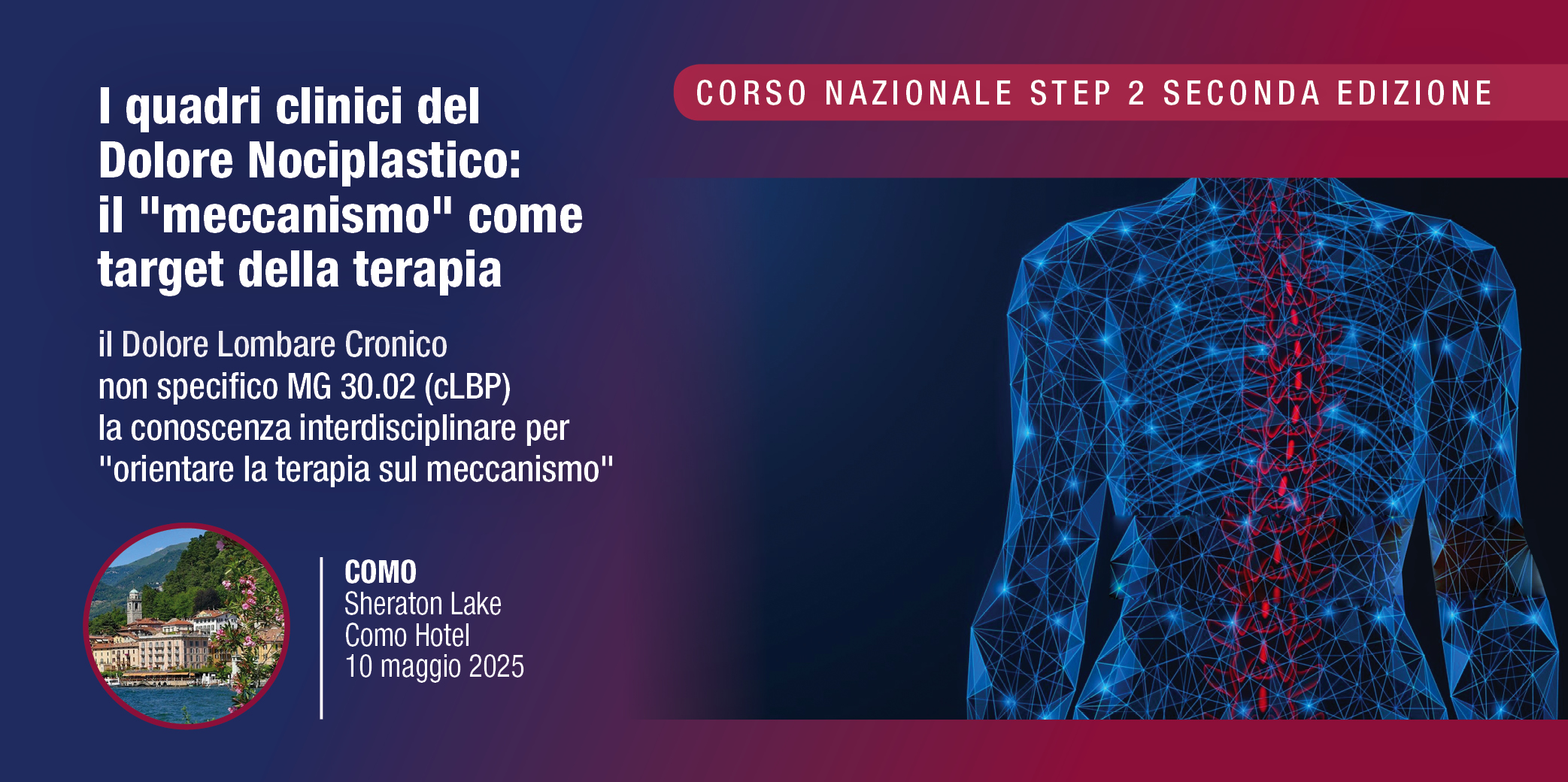 Como, 10 Maggio 2025 – Corso Nazionale RES Step 2: ” I quadri clinici del Dolore Nociplastico: il “meccanismo” come target della terapia”