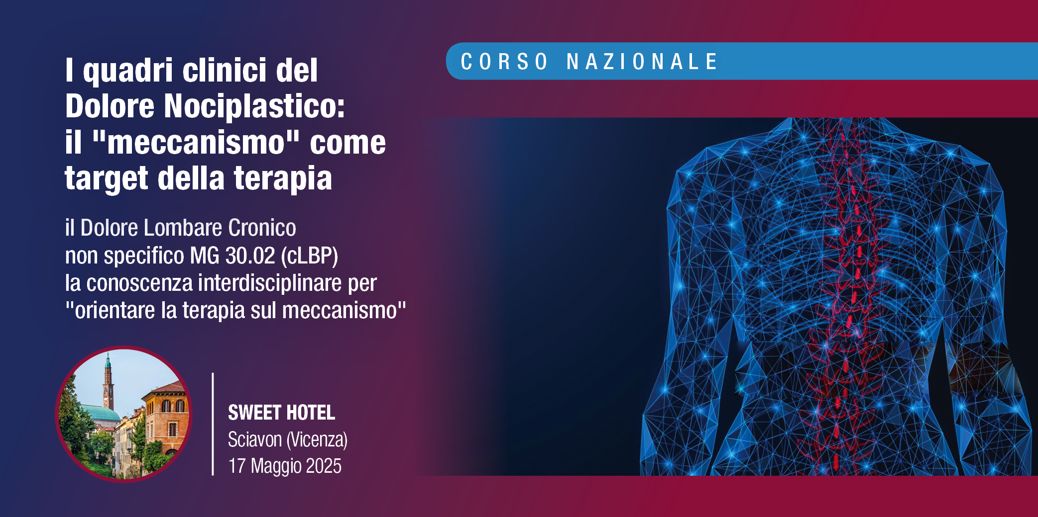 Schiavon (Vicenza), 17 Maggio 2025 – Corso RES: “I quadri clinici del Dolore Nociplastico: il “meccanismo” come target della terapia”